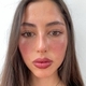 Antonia Staeding D.